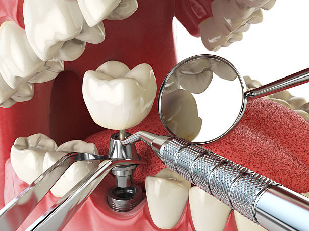 Best Dentist for Tooth Abscess  in Big Lake, MN